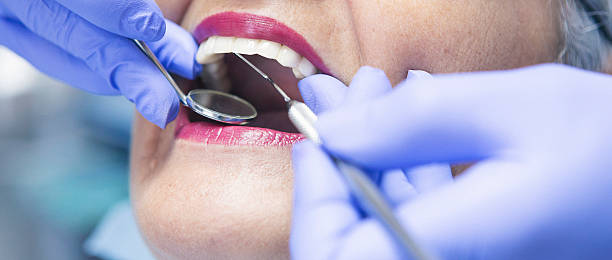 Dentist for Dental Trauma in NY